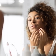 Acné : causes, préventions et traitement de ces boutons rebelles